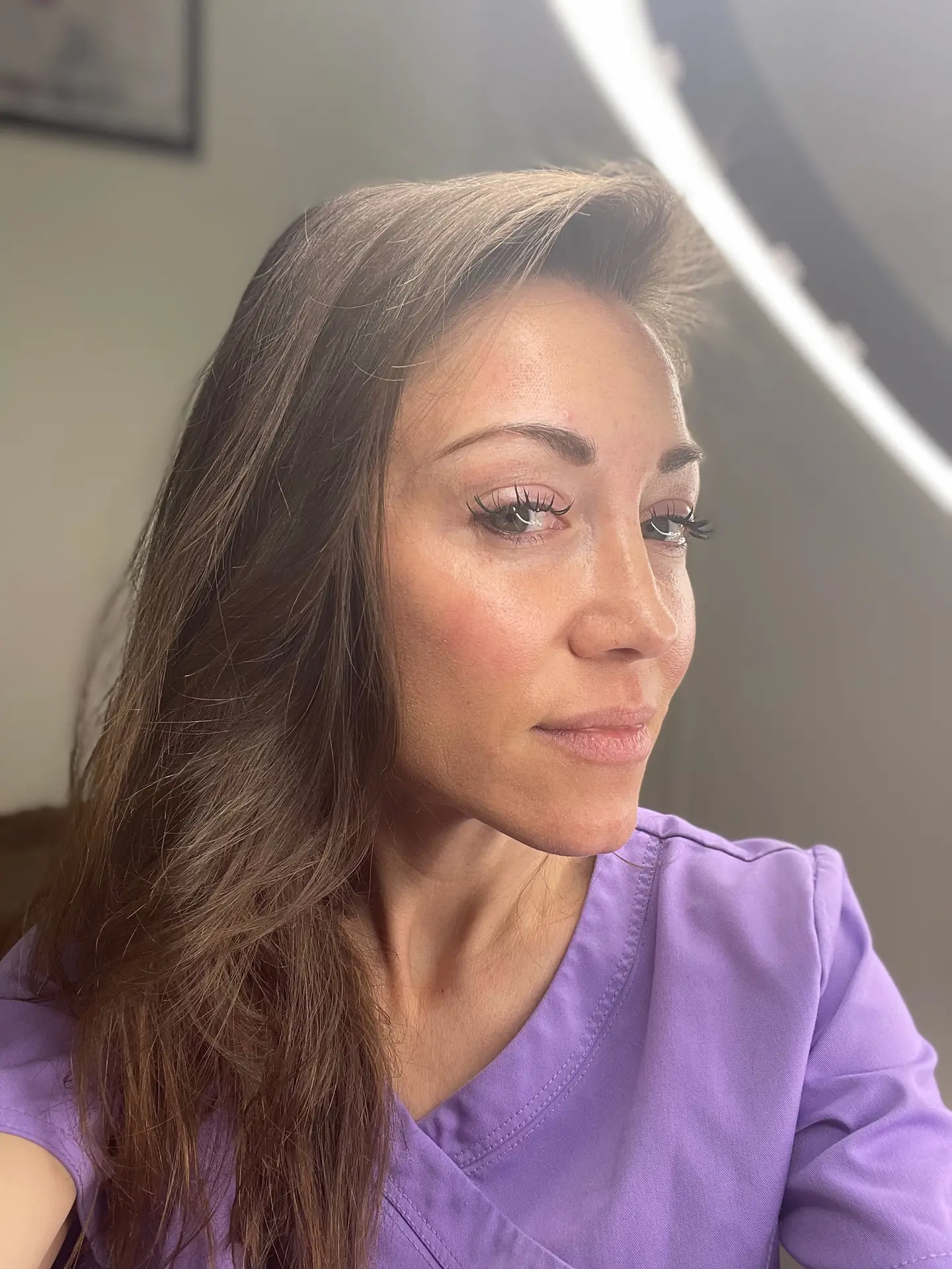 Skin seven or more days after CO2 laser treatment